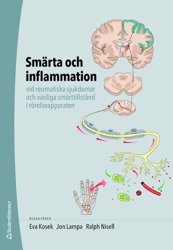 Smärta och inflammation - vid reumatiska sjukdomar och vanliga smärttillstånd i rörelseapparaten