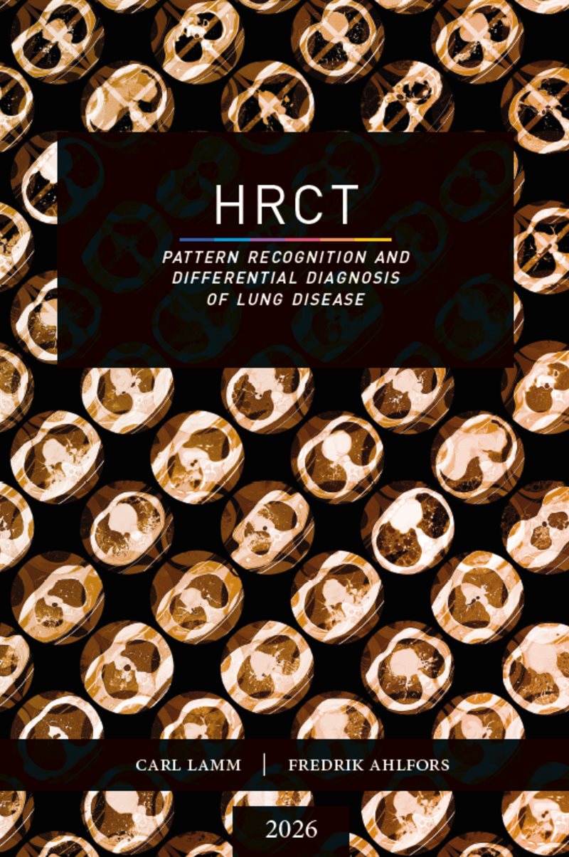 HRCT - Pattern Recognition and Differential Diagnosis of Lung Disease